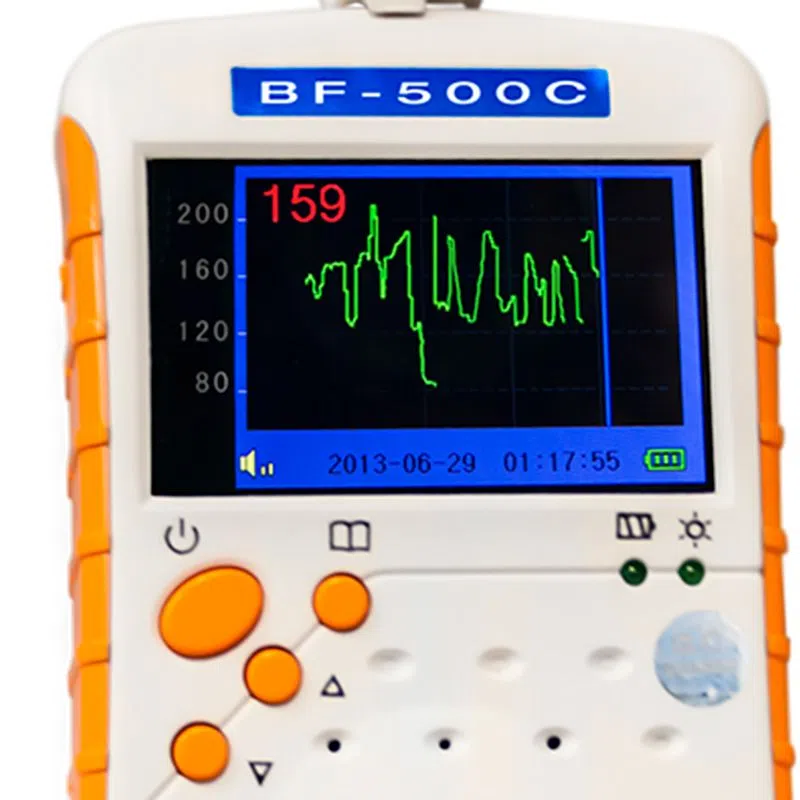 DOPPLER FETAL DE BOLSILLO 